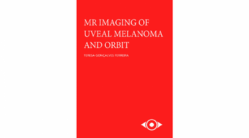 Omslag proefschrift 'MR image of uveal melanoma and orbit'